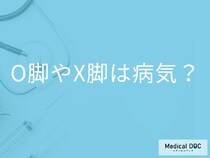O脚・X脚は病気？ “正常な足の変化”と注意すべきサイン【医師解説】