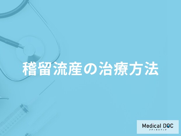 「稽留流産の治療方法」は何かご存じですか?医師が解説!
