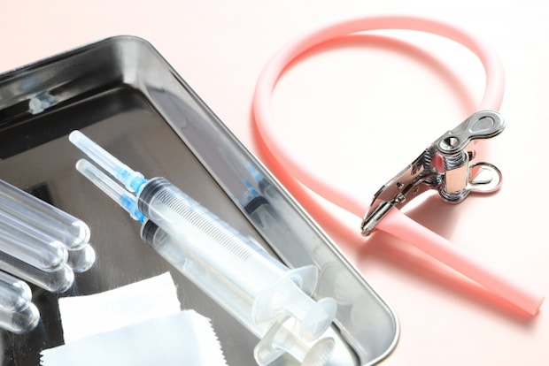 シェーグレン症候群の検査と診断