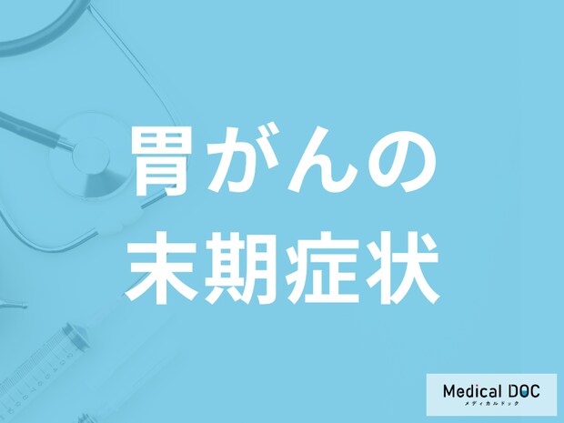 「胃がんの末期症状」はご存じですか？ステージ別の生存率も医師が解説！