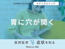 「胃に穴が開く」原因はご存知ですか？胃に穴が開く前兆症状も医師が解説！