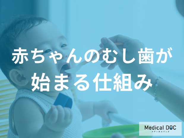 「赤ちゃんのむし歯」が発生してしまうのはなぜ?むし歯ができる仕組みを解説!