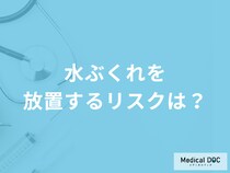 「水ぶくれを放置するリスク」は何かご存知ですか？注意点も医師が解説！