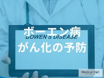 「ボーエン病のがん化を予防する治療法」はご存じですか？医師が解説！