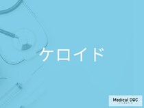 かゆい・痛い・赤く盛り上がる傷跡　放置すると悪化する「ケロイド」とは？