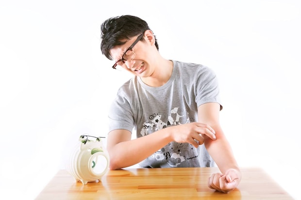 虫刺され（虫刺症）