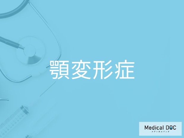 「なんか顔が左右で違う…」それ、顎変形症かも？早めに気づくサインとは