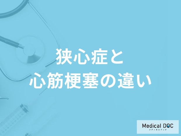 「狭心症と心筋梗塞の違い」はご存知ですか？それぞれの症状も医師が解説！
