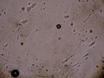 「白癬菌(はくせんきん)」とは？原因や感染経路・症状についても解説！