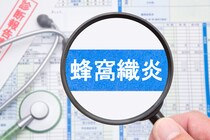 「蜂窩織炎(ほうかしきえん)」とは？症状・原因・治療についても解説！