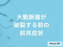 「大動脈瘤」が破裂する前の5つの前兆症状はご存知ですか？【医師解説】