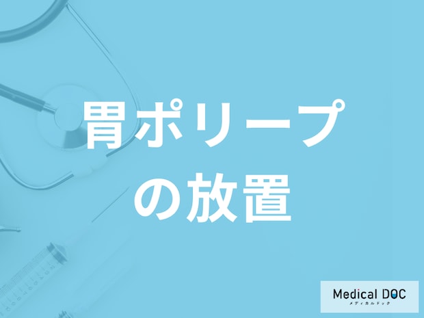 「胃ポリープを放置する」とがん化する可能性はあるのか？原因も医師が解説！