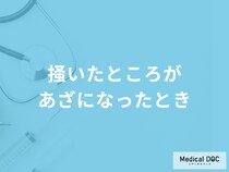「掻いたところがあざになったとき」の治し方は？考えられる病気も医師が解説！