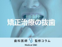 矯正治療で歯を｢抜く･抜かない｣の判断基準は? 抜歯が必要な理由やメリット･デメリットを解説