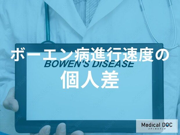 「ボーエン病進行速度に個人差」はあるのか?要因を解説!【医師監修】
