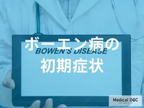 「ボーエン病」を発症すると皮膚がどう変化する？初期症状を解説!【医師監修】