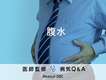 「腹水」の初期症状・原因はご存知ですか？医師が監修！