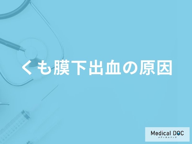 「くも膜下出血の原因」はご存知ですか？医師が徹底解説！