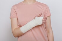 「骨折」とは？症状・種類・治療法についても解説！