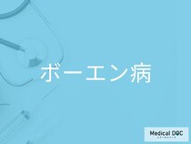 しつこい湿疹、実は「皮膚がん」かも？ 見逃されやすい“ボーエン病”とは【医師監修】