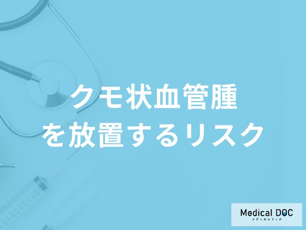 「クモ状血管腫を放置する」と何の病気になる「リスク」がある？医師が徹底解説！