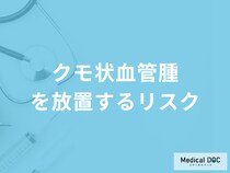 「クモ状血管腫を放置する」と何の病気になる「リスク」がある？医師が徹底解説！