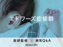 「エドワーズ症候群」の症状・原因はご存知ですか？医師が監修！