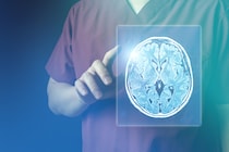 「島弁蓋部てんかん」に対する新たな治療法を発表