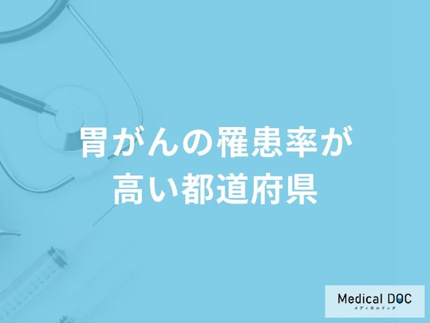 「胃がんの罹患率が高い都道府県」はご存知ですか？男女別のTOP3位を解説！