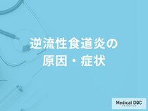 「逆流性食道炎の原因・症状」はご存知ですか？【医師監修】