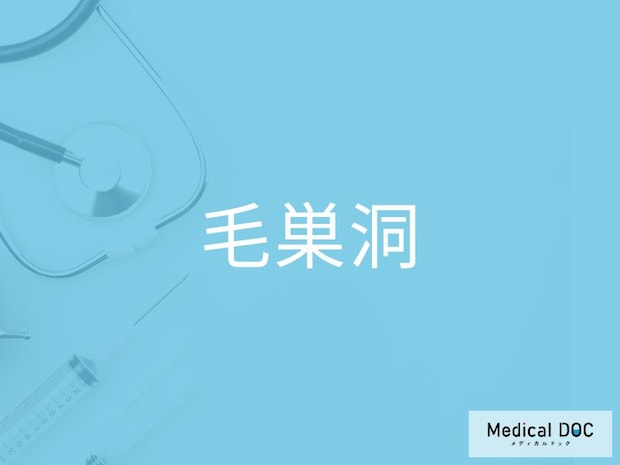 お尻の痛み、それ「毛巣洞」かも？ 座りっぱなしの人が注意すべき病気を医師が解説