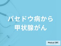 「バセドウ病から甲状腺がんになる」ことはある？甲状腺がんの症状も医師が解説！