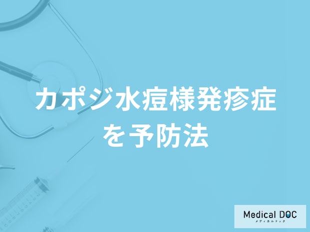 「カポジ水痘様発疹症」の家族内感染を防ぐには？予防法について医師が解説！