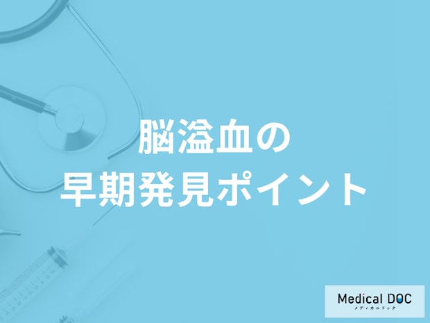 「脳溢血の早期発見ポイント」はご存じですか？予防法も医師が解説！