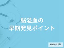 「脳溢血の早期発見ポイント」はご存じですか？予防法も医師が解説！