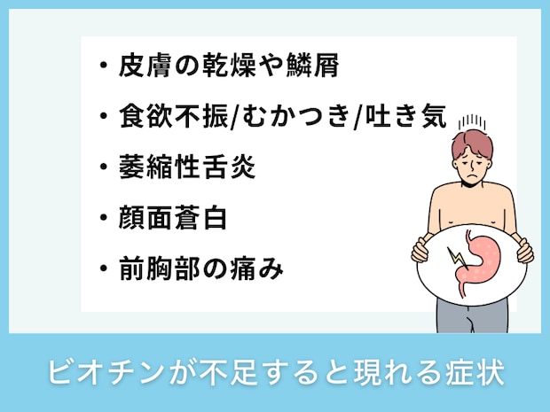 ビオチンが不足すると現れる症状
