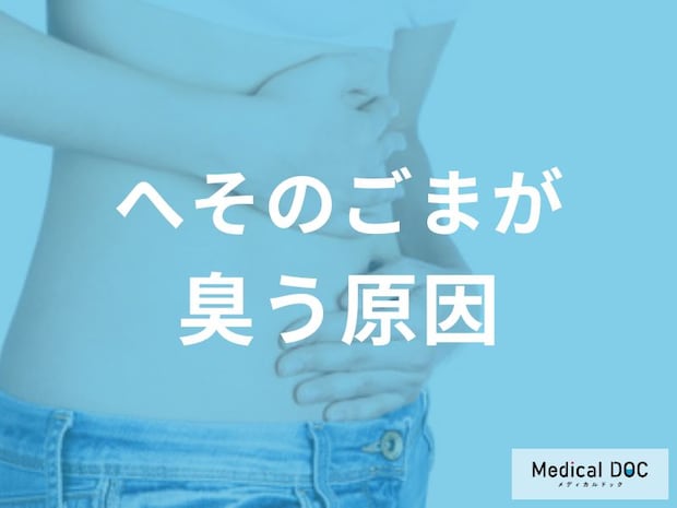 「へそのごま」が臭いのは危険なサイン? 細菌繁殖と臍炎のリスクとは