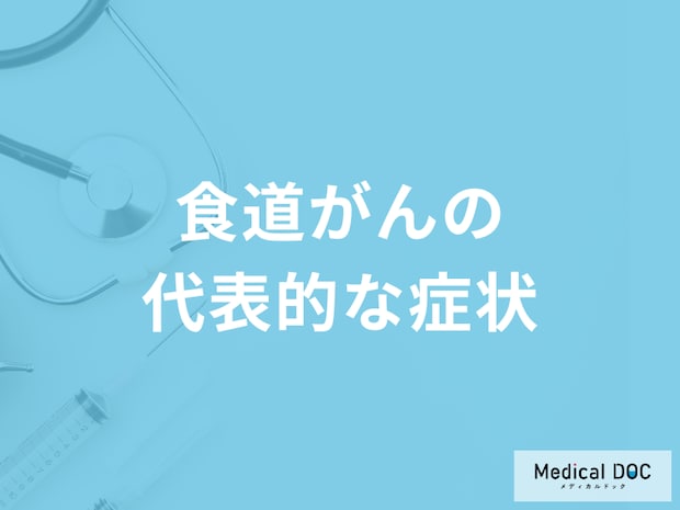 「食道がん」の4つの症状はご存知ですか？発症しやすい年齢層も医師が解説！