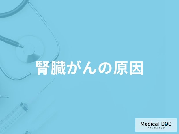 「腎臓がんの原因」はご存知ですか？【医師監修】