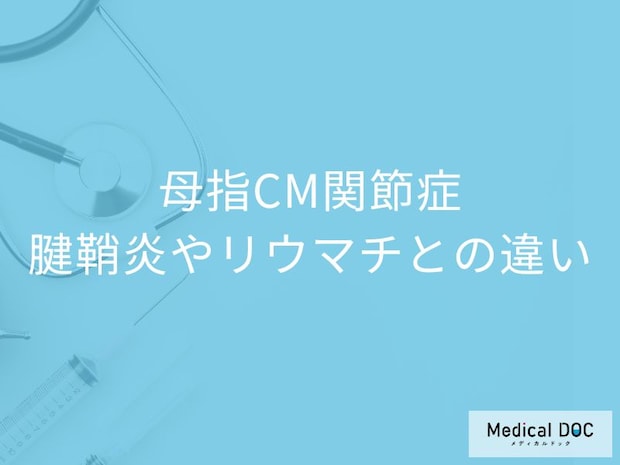 親指の痛みを放置すると危険? 腱鞘炎・リウマチ・母指CM関節症の違いを医師解説