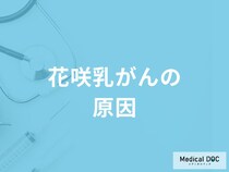 「花咲乳がんを発症する2つの原因」はご存知ですか？【医師監修】