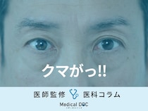 『クマ』の専門家が「どう対処すべきか」を解説 “黒クマ・茶クマ”対策とは