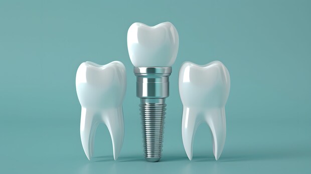 インプラント治療について