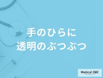 「手のひらに透明のぶつぶつ」ができる原因はご存知ですか？考えられる病気も解説！
