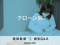 「クローン病」になると現れる症状・発症しやすい人の特徴はご存知ですか？