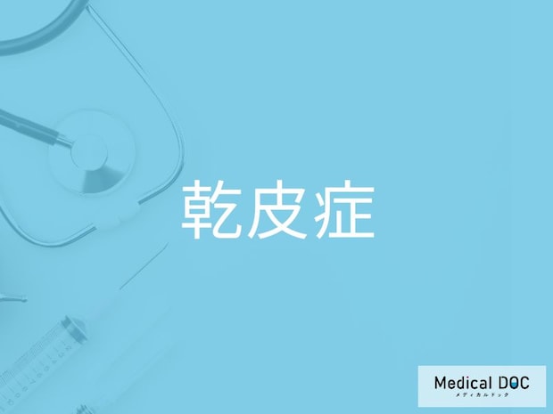 「乾皮症」のリスクが高い人の特徴を医師が解説 40代以降に増える背景と対処法