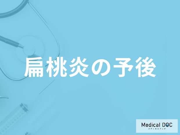 「扁桃炎の治療中・治療後の注意点」はご存じですか?予後を医師が解説!