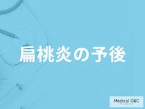「扁桃炎の治療中・治療後の注意点」はご存じですか？予後を医師が解説！