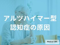 「アルツハイマー型認知症の主な3つの原因」はご存知ですか？【医師監修】