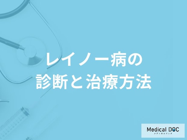「レイノー病」は何科を受診すればいいの？治療法や対処法も解説！【医師監修】